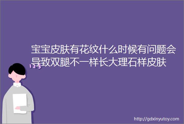 宝宝皮肤有花纹什么时候有问题会导致双腿不一样长大理石样皮肤